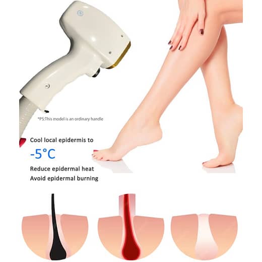 Four Wavelengths Diode Laser Hair Removal Machine - SNKOO BEAUTY