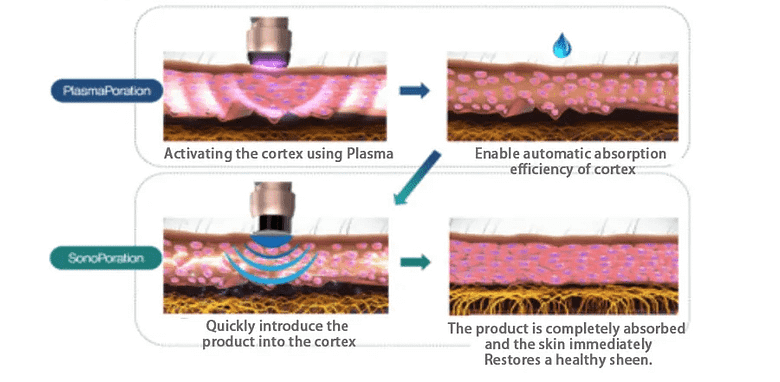 Fractional Plasma Beauty Machine - SNKOO BEAUTY